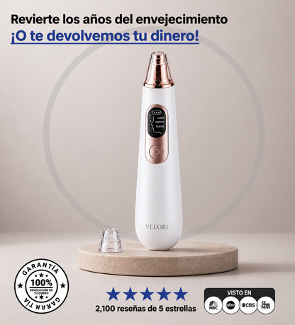 Maison Velvet™ | Succionador de Puntos Negros - Poros Limpios en Minutos